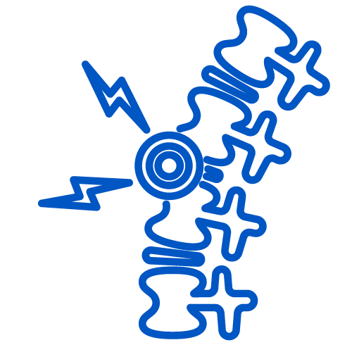 Sciatica